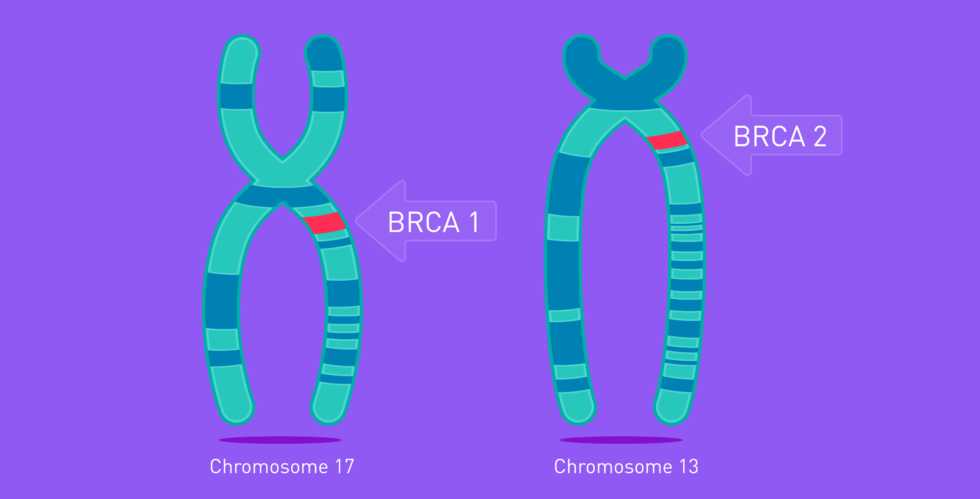 BRCA 1 και 2: Τα γονίδια του καρκίνου του μαστού και των ωοθηκών – Πότε να κάνω γονιδιακό έλεγχο